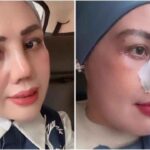 Elly Sugigi Jalani Operasi Plastik Demi Bangkit dari Hinaan, Habiskan Rp65 Juta untuk Hidung dan Mata